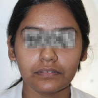 Pre-treatment photograph
