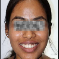 Pre-treatment photograph