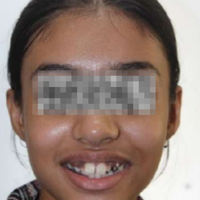 Pre-treatment photograph