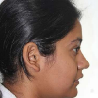 Pre-treatment photograph