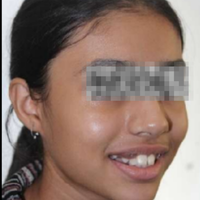 Pre-treatment photograph