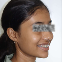 Mid-treatment photograph