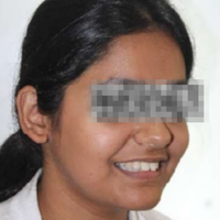 Pre-treatment photograph