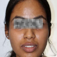 Pre-treatment photograph