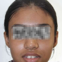 Pre-treatment photograph