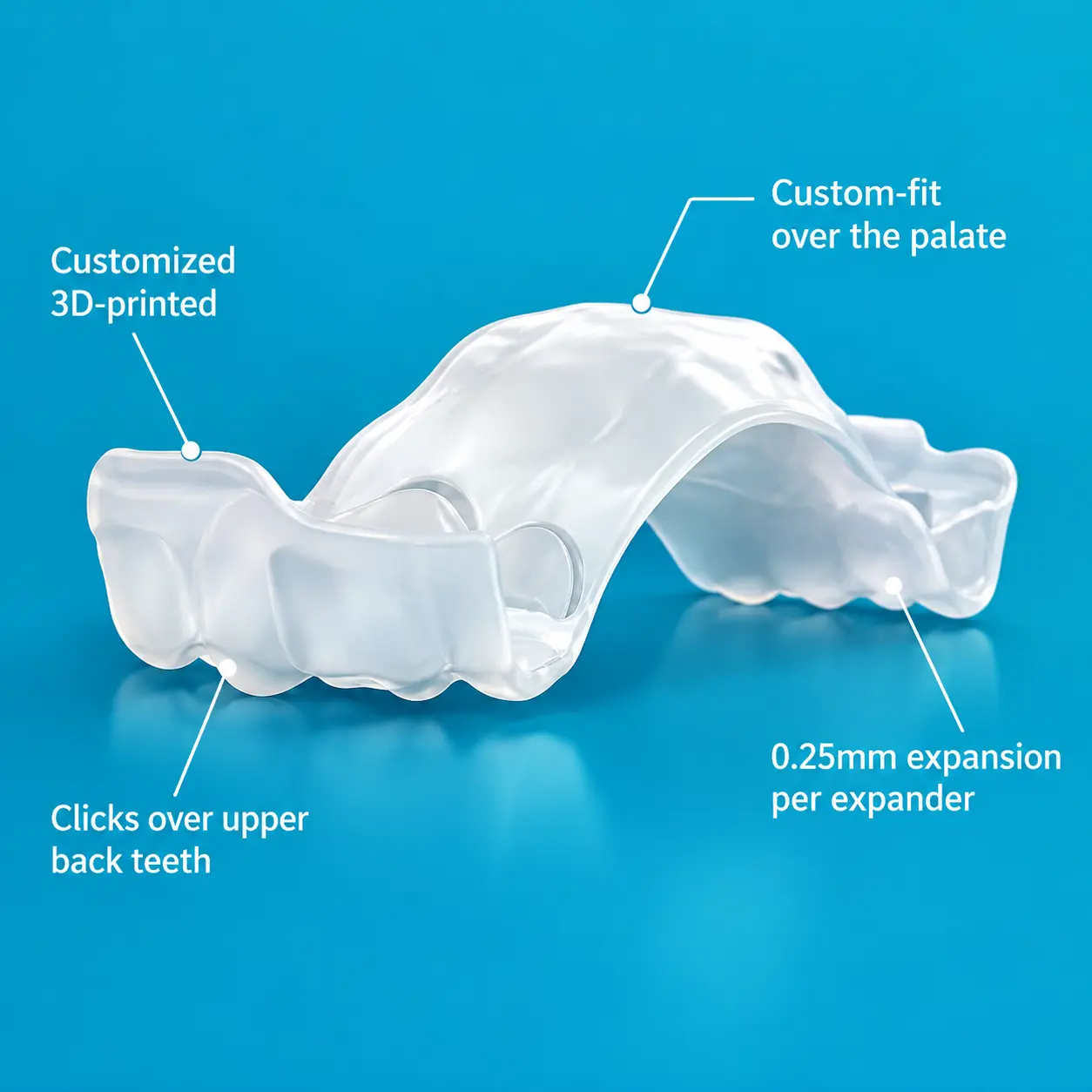 Invisalign Palatal Expander
